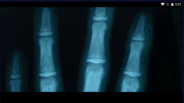 骨骼检测仪软件下载手机版(Xray Hand Scanner Prank)