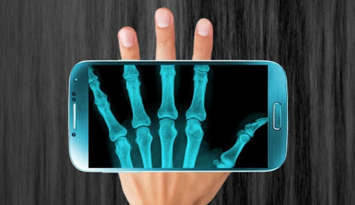 骨骼检测仪软件下载手机版(Xray Hand Scanner Prank)