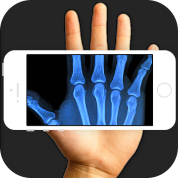 骨骼检测仪软件下载手机版(Xray Hand Scanner Prank)
